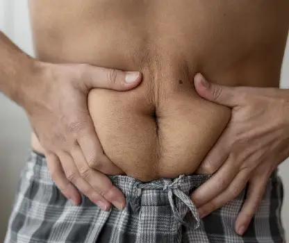 Umbilical Hernia