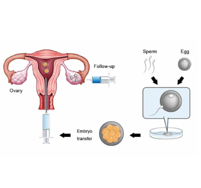 embryo transfer